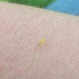 Yellow Fly????